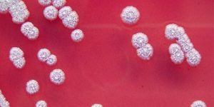 Опасный микроорганизм может убить за 24 часа