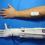 Инженер из Норильска займется производством дешевых бионических протезов