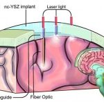«Окно в мозг» поможет в лечении многих заболеваний