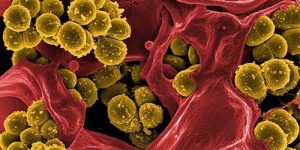 Ученые нашли возможность разрушить бактерии стафилококка, «засолив» их