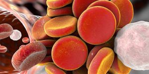 Найдена причина тромбоза у онкобольных