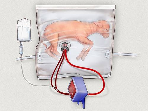 Искусственную матку успешно протестировали на зародышах овец