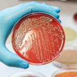 Новый тест выявит устойчивые к антибиотикам бактерии