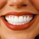 Гвозди вместо стоматологических боров