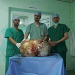 Алжирские врачи вырезали пациентке гигантскую опухоль яичников